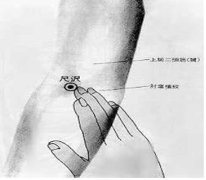 뜸 이미지