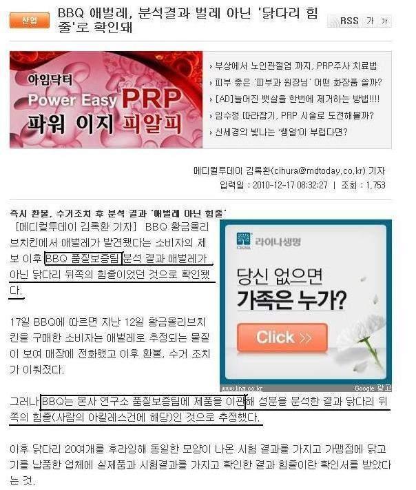 힘줄 이미지