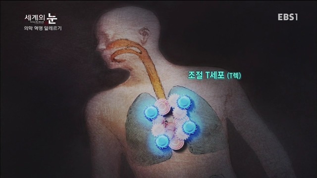 다큐 세계의 눈 - 의학 혁명 알레르기 | 인스티즈
