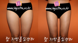 탑바디클리닉 이미지