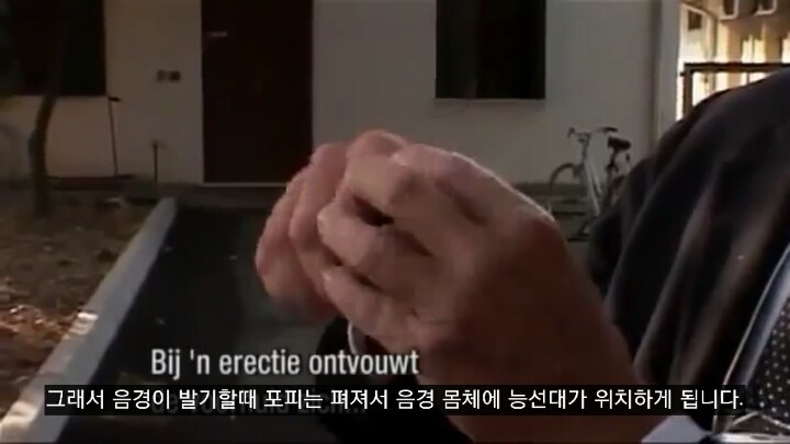 포경수술을 반대하는 의사들이 말하는 포경수술의 진실 | 인스티즈