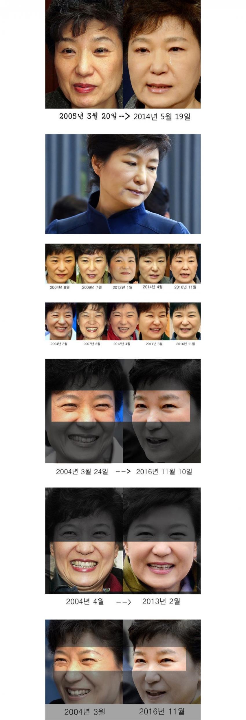 현대 의학 기술의 위력 | 인스티즈