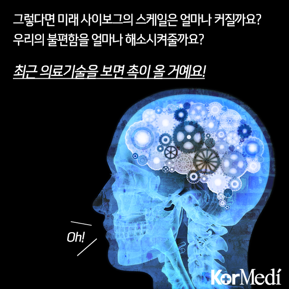 당신의 미래가 사이보그라면?: 미래 의료 신기술 | 인스티즈