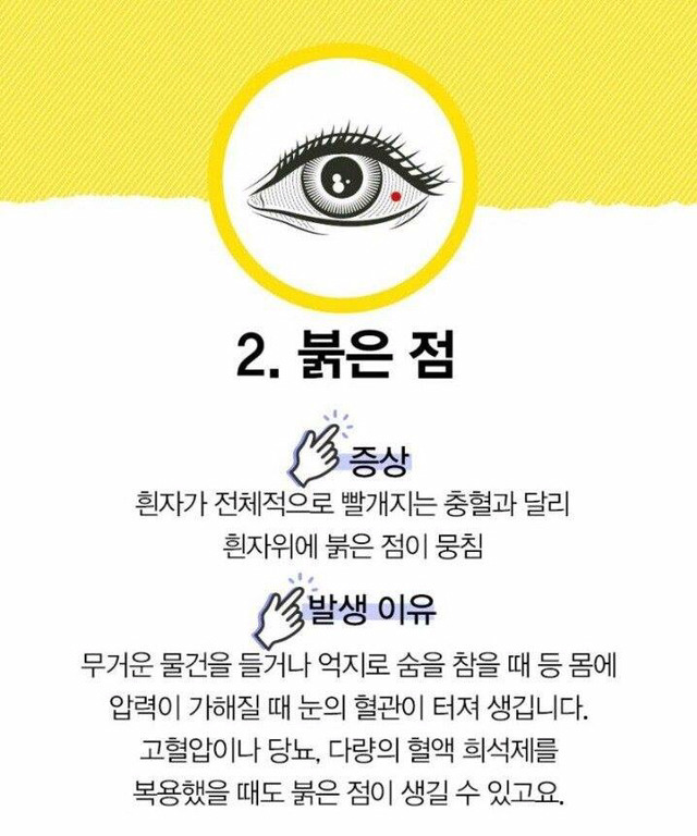 눈으로 알 수 있는 질병 | 인스티즈