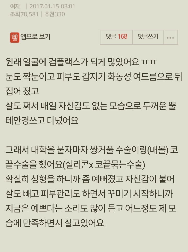 성형사실 꼭 의무적으로 말해야하나요? | 인스티즈