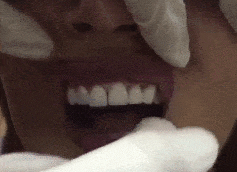 의외로 잘 모르는 라미네이트의 현실.gif | 인스티즈