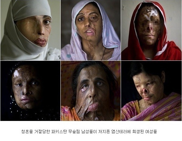파키스탄 여성들이 청혼을 거절하면 겪는 일 | 인스티즈