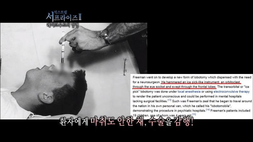[서프라이즈] 잘못된 수술 레이크우드의 망령.jpg | 인스티즈